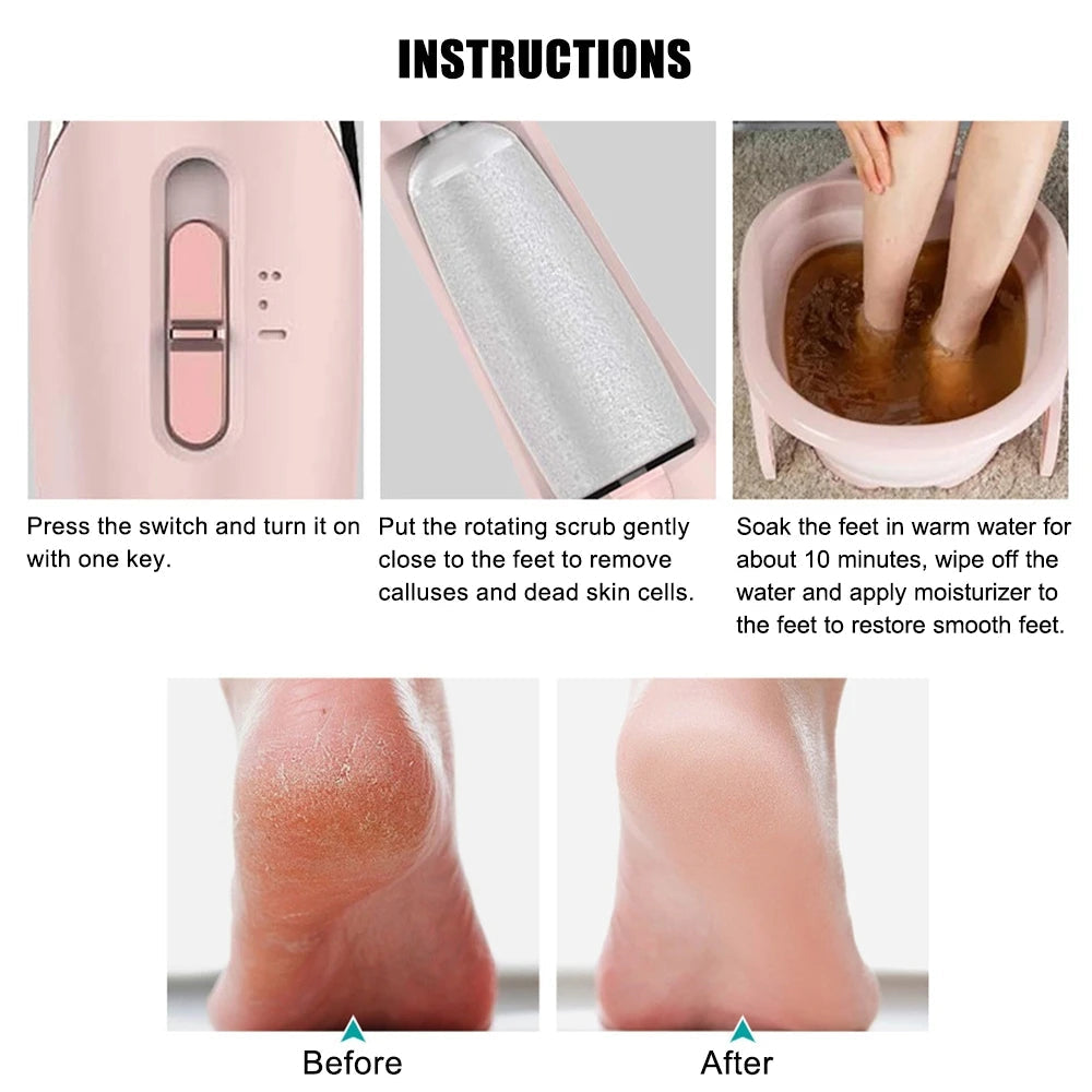 SoleRenew Waterproof Callus Remover