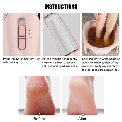 SoleRenew Waterproof Callus Remover